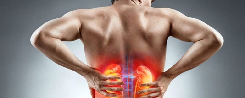 Casos de pedras nos rins aumentam até 30% durante o verão. Conheça as causas