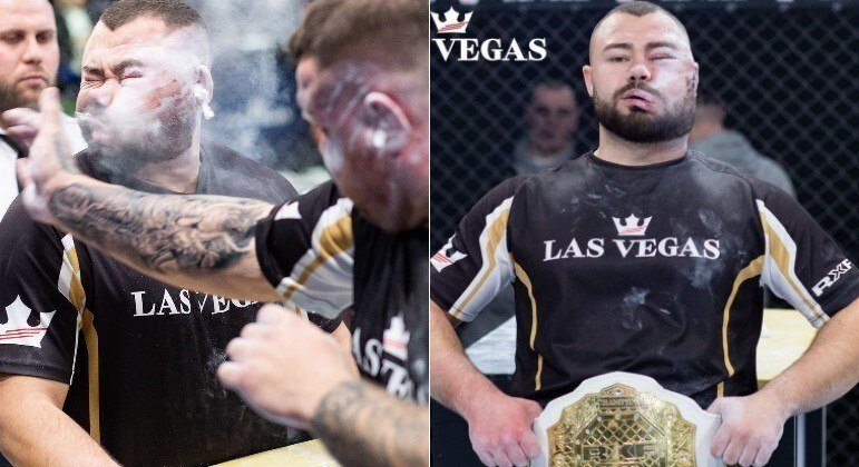 Em competição de tapa na cara, valentão ganha R$ 27.500 e rosto desfigurado. Veja vídeo