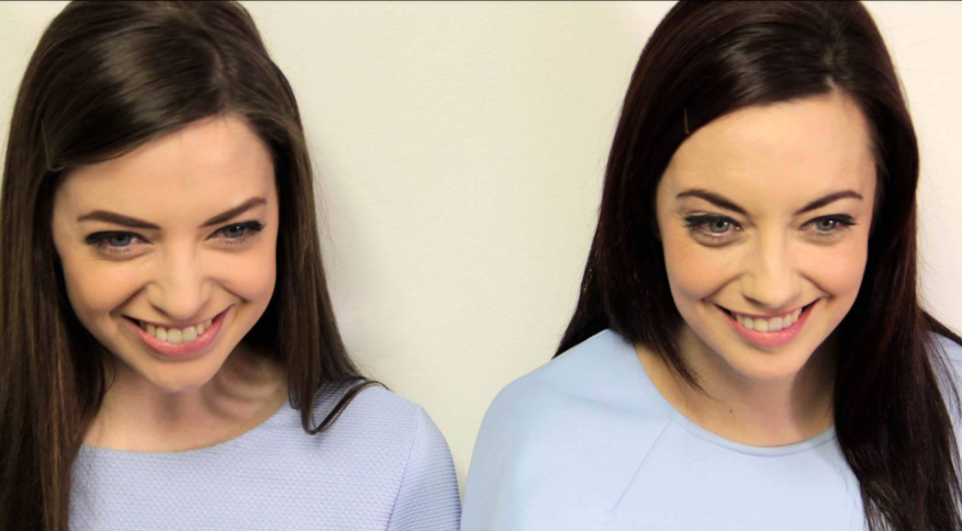 Irlandesa encontra mulher idêntica e elas resolvem fazer teste de DNA; veja o resultado