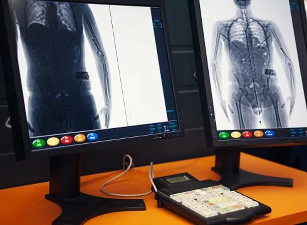 O que o scanner corporal dos aeroportos mostram?