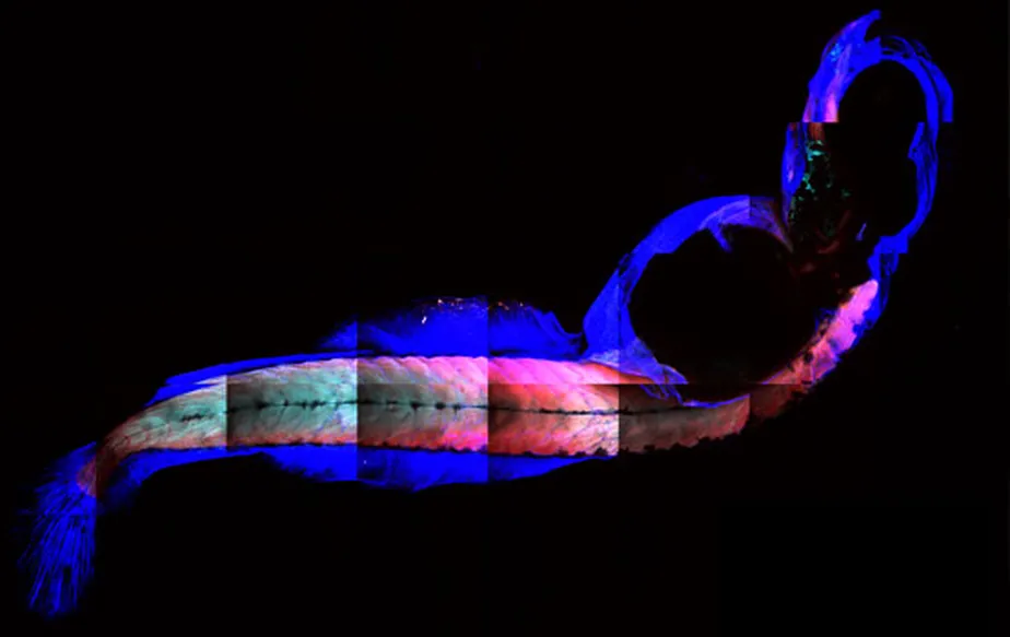 Estudo com peixes pode ter solução para o envelhecimento muscular humano