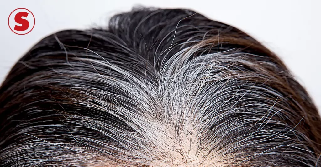 Loção brasileira que reverte cabelos brancos também pode ser usada em pelos íntimos