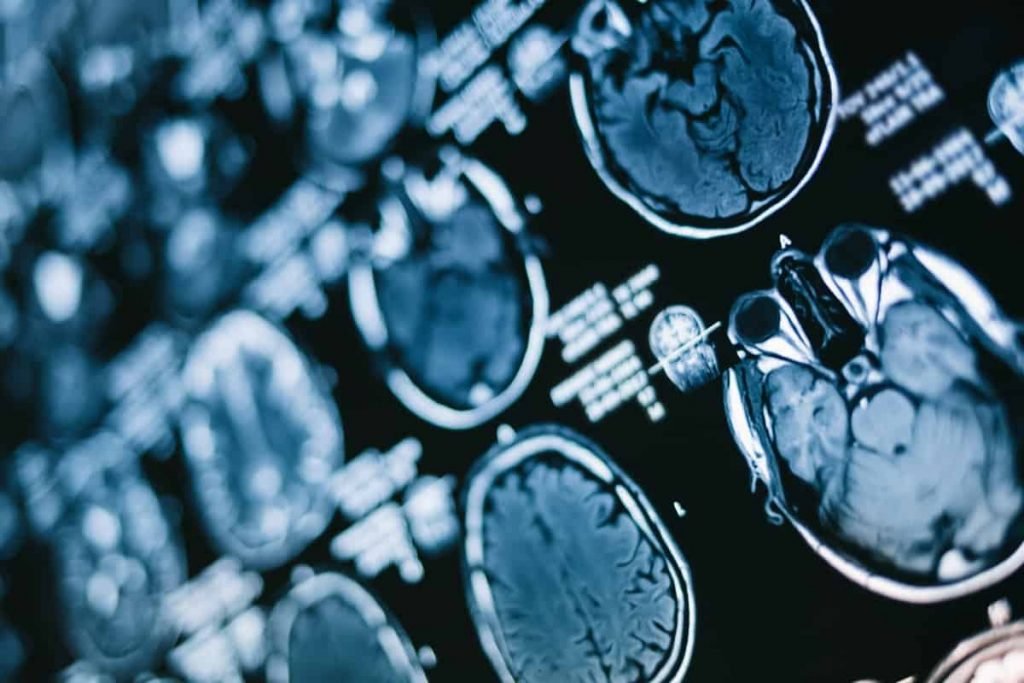 Descoberta de qual área do cérebro toma decisões pode mudar nossos hábitos; entenda