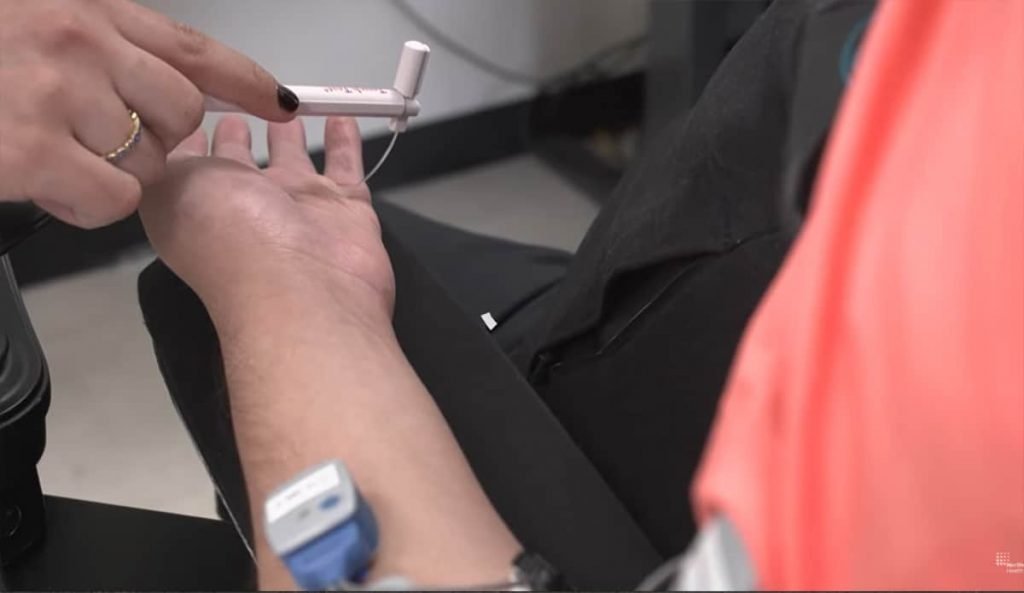 Chip cerebral recupera sensibilidade e movimento nas mãos de paciente tetraplégico