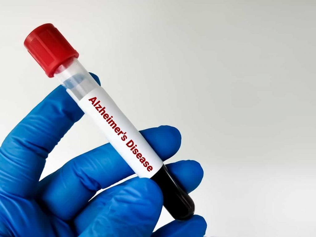 Exame de sangue revolucionário para pacientes com câncer de mama e pulmão evita quimioterapia