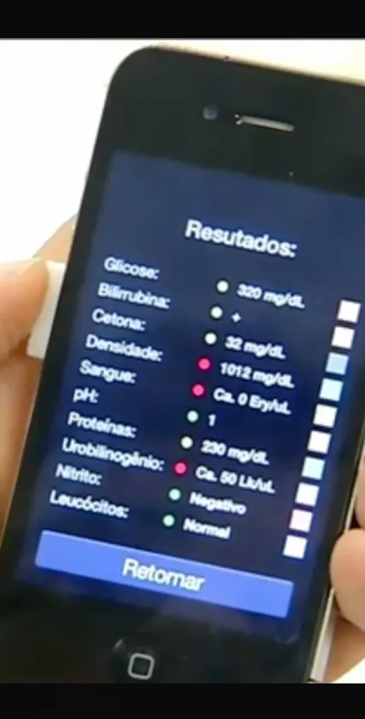 Projeto da UFRN permite exame de urina com celular