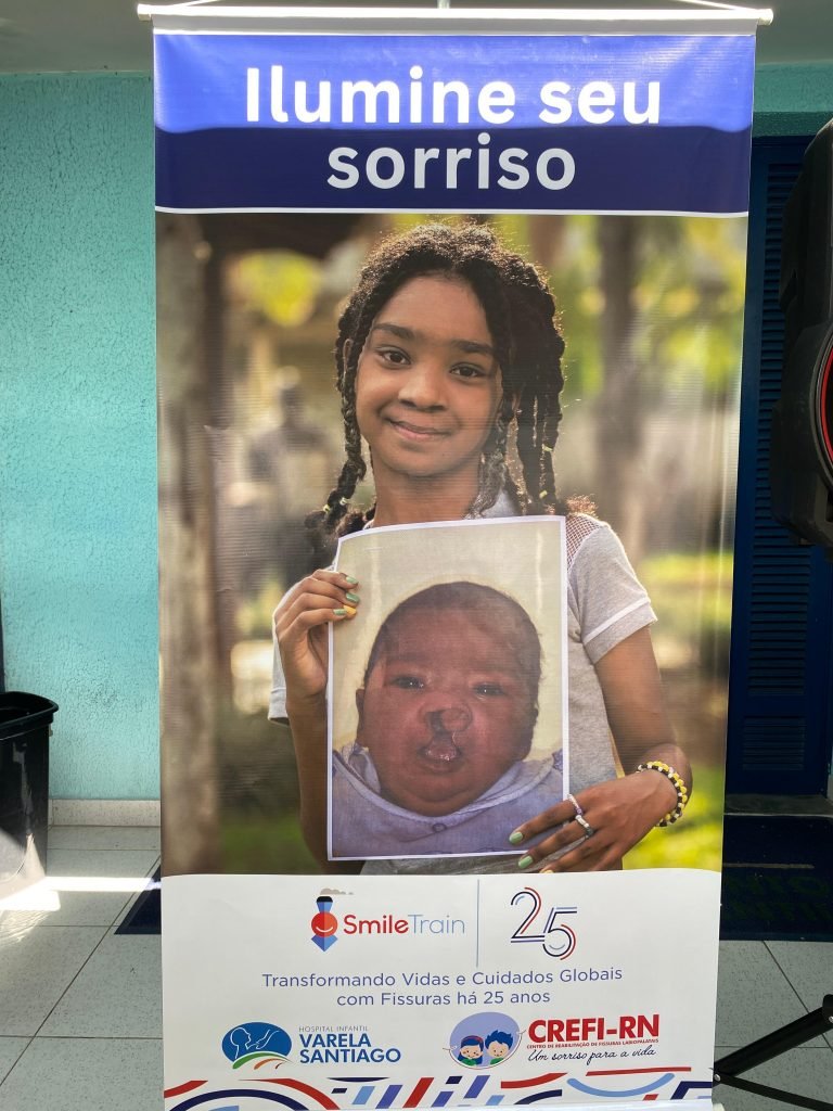 Hospital Infantil Varela Santiago se mobiliza com a Smile Train em ação global que quebra recorde mundial no Dia do Sorriso