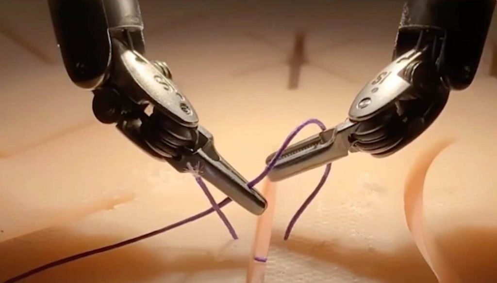 Robô médico faz cirurgia de maneira inédita – assista