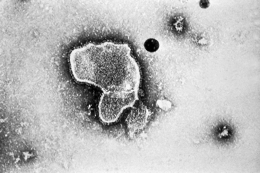 HMPV: saiba mais sobre surto de doença viral que tem acometido crianças na China