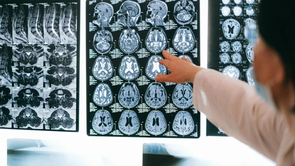 Estresse na pandemia pode ter envelhecido nossos cérebros, diz estudo
