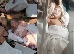 Bebê de 15 dias é abandonado com pedra na boca e lábios colados