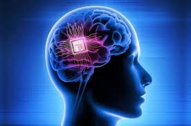 Implante cerebral promete reduzir crises de epilepsia em 50%