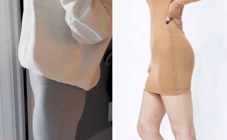 ‘Os resultados superam qualquer sensação macabra’, diz usuária de gordura de morto injetada no seu corpo