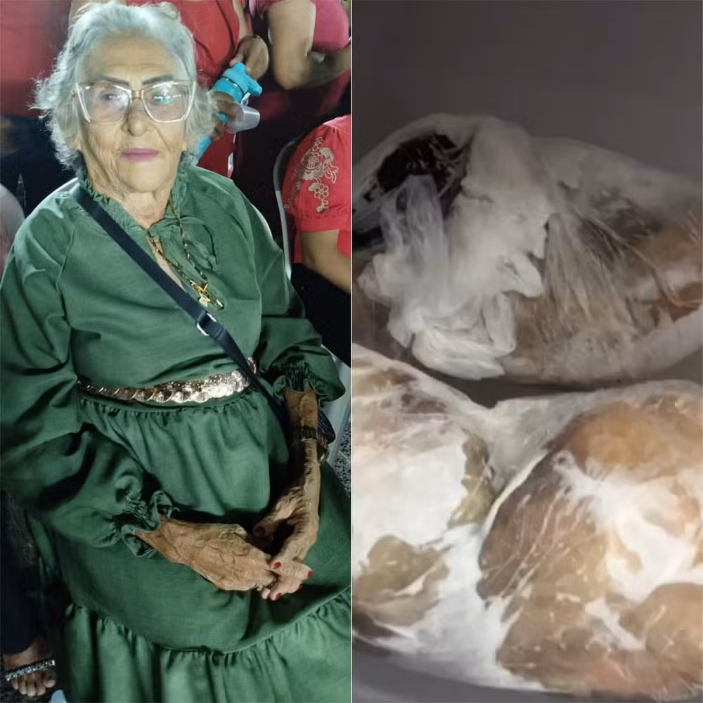 Idosa com suspeita de intoxicação por ciguatera morre após quase um mês internada no RN