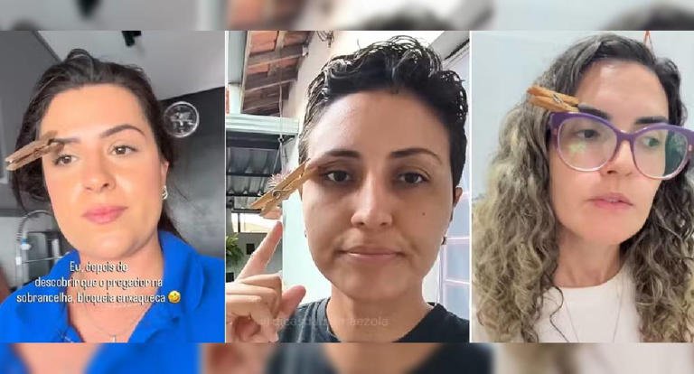 Pregador na sobrancelha contra enxaqueca? Técnica viral pode enganar a dor, mas não trata o problema