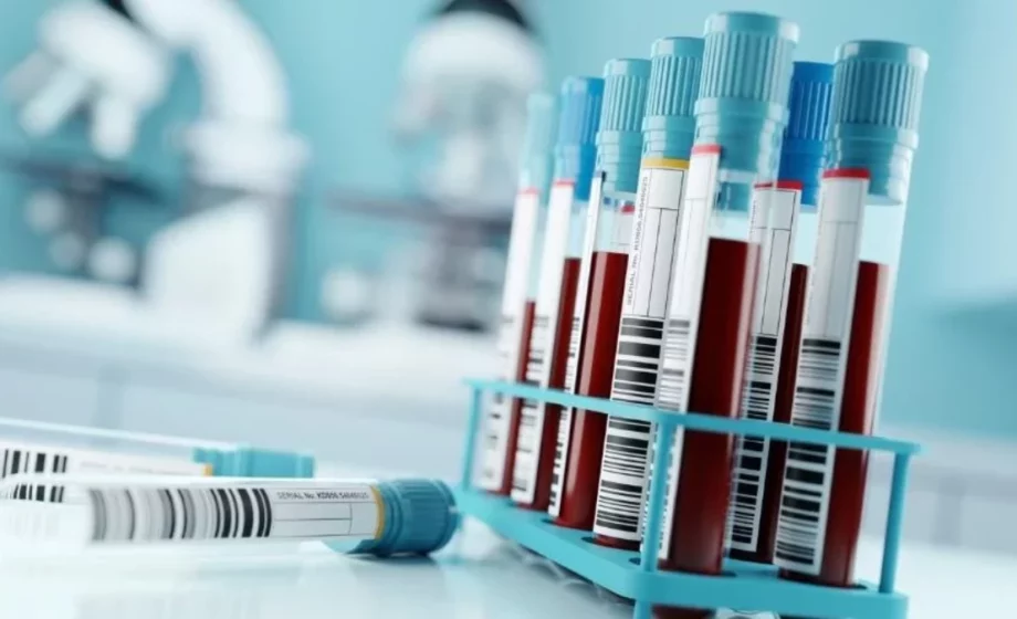 Galleri: o exame de sangue capaz de identificar mais de 50 tipos de câncer e revelar sua localização