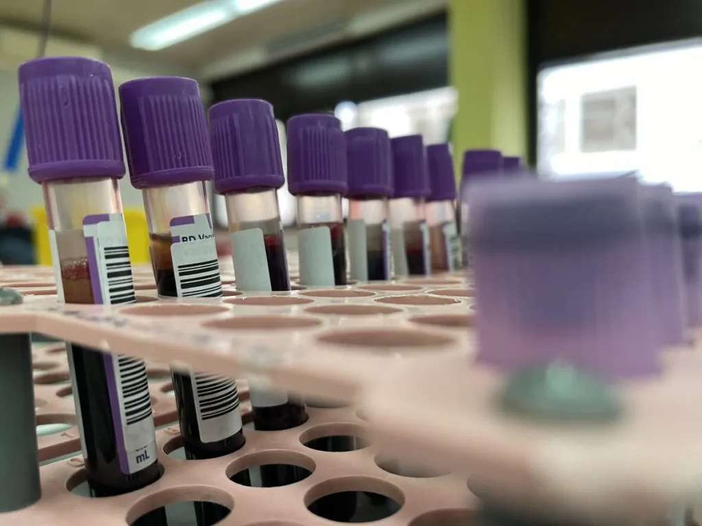 Estudo indica que jejum universal para exames de sangue é desnecessário